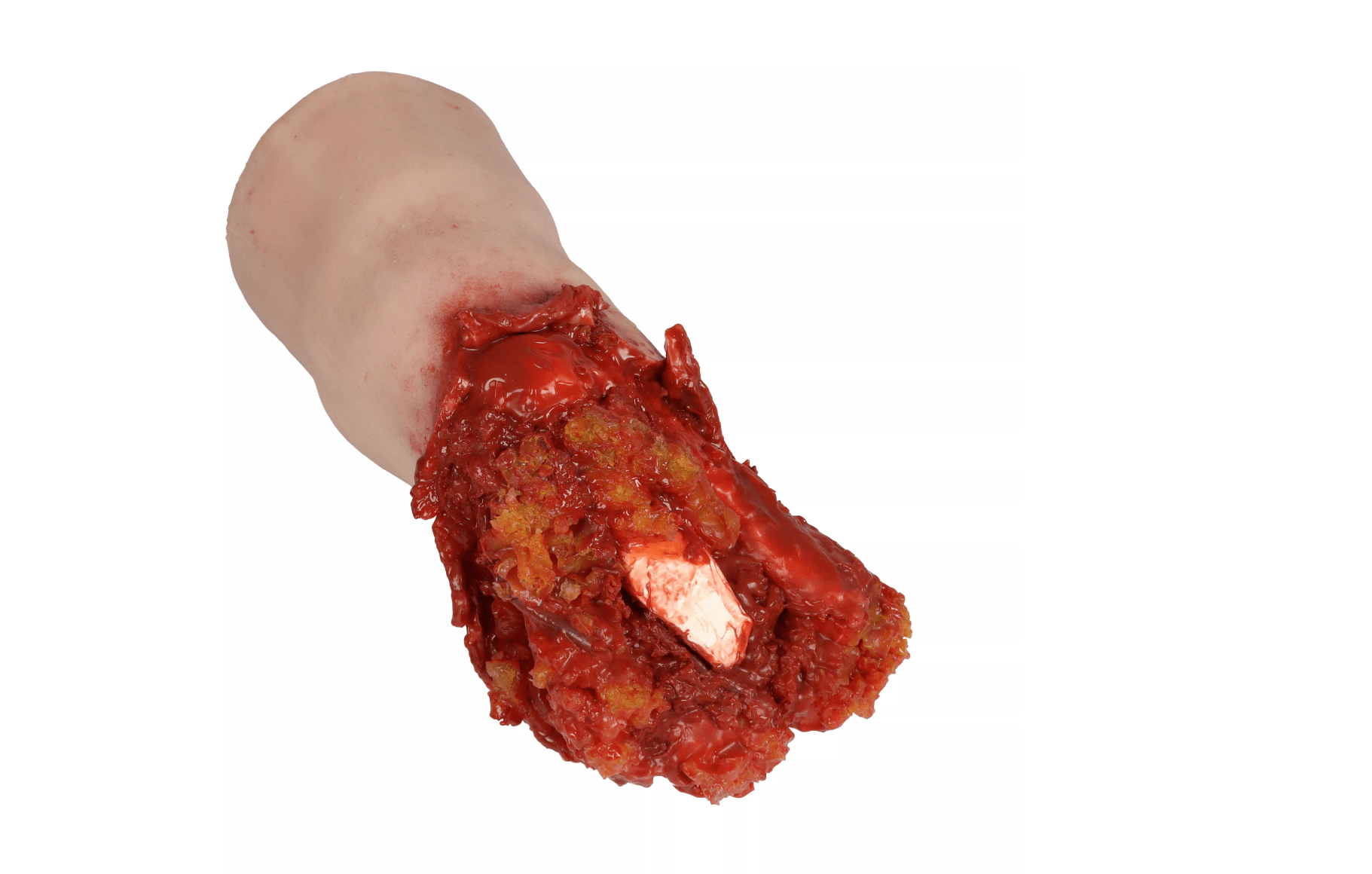 Amputiertes Bein Task Trainer - Erler - Zimmer